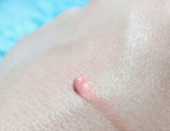 Biodermal Sun Lipbalm SPF25 - Tube 12 Ml - Natural Pink - Lippenbalsem 7 Biodermal Sun Lipbalm SPF25 - Tube 12 Ml - Natural Pink - Lippenbalsem -Schoonheidsproducten Winkel 1200x927